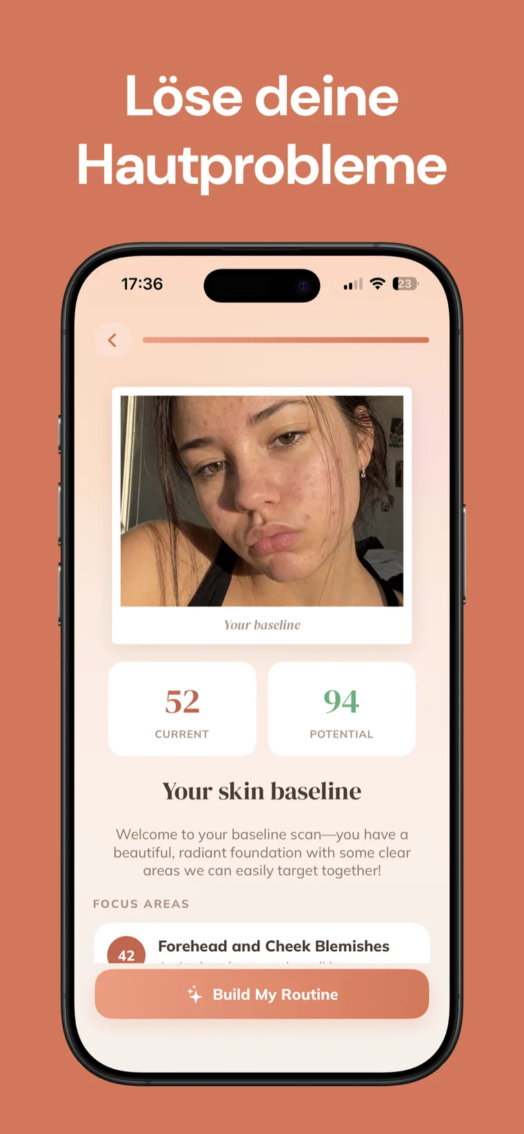 Löse deine Hautprobleme — Hautpflege-Routine zeigt einen Basis-Gesichtsscan mit aktuellem und potenziellem Haut-Score und Fokusbereichen