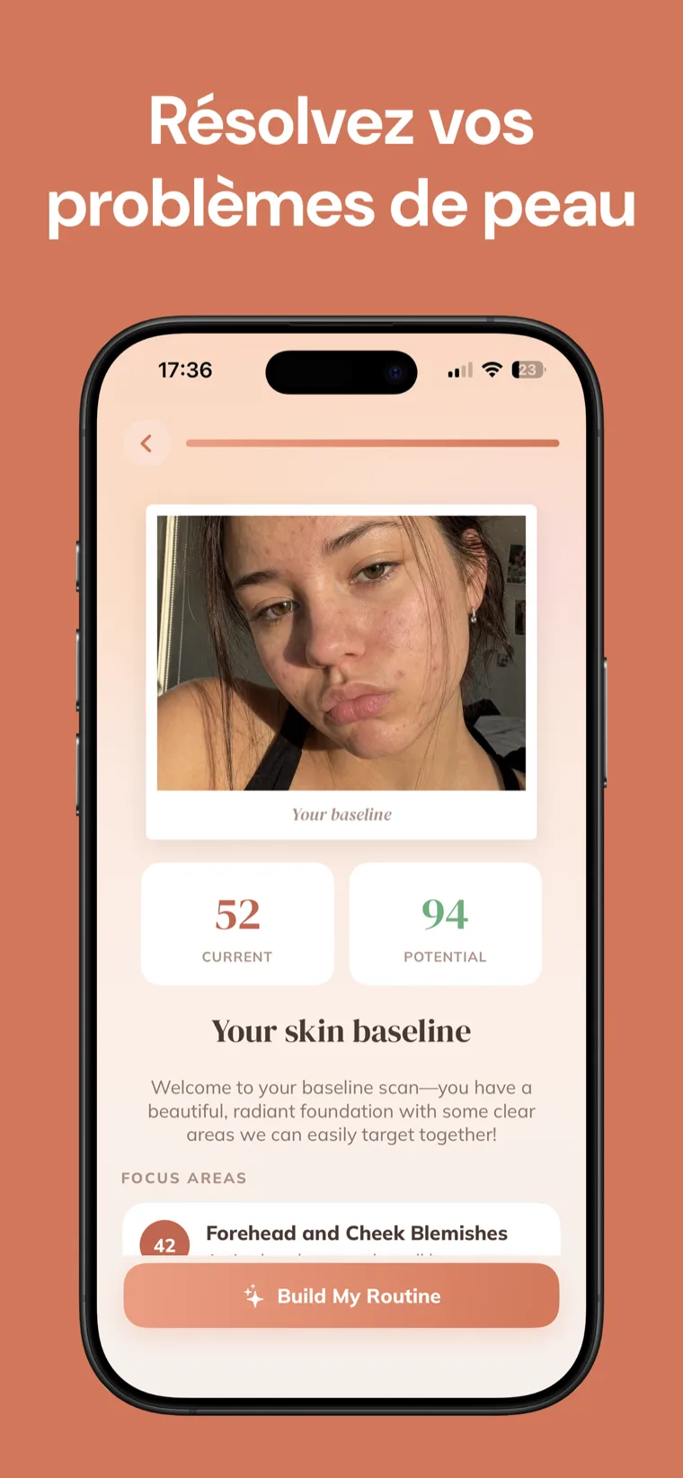 Résolvez vos problèmes de peau — Skincare Routine affichant un scan initial du visage avec un score cutané actuel et potentiel et des zones à cibler