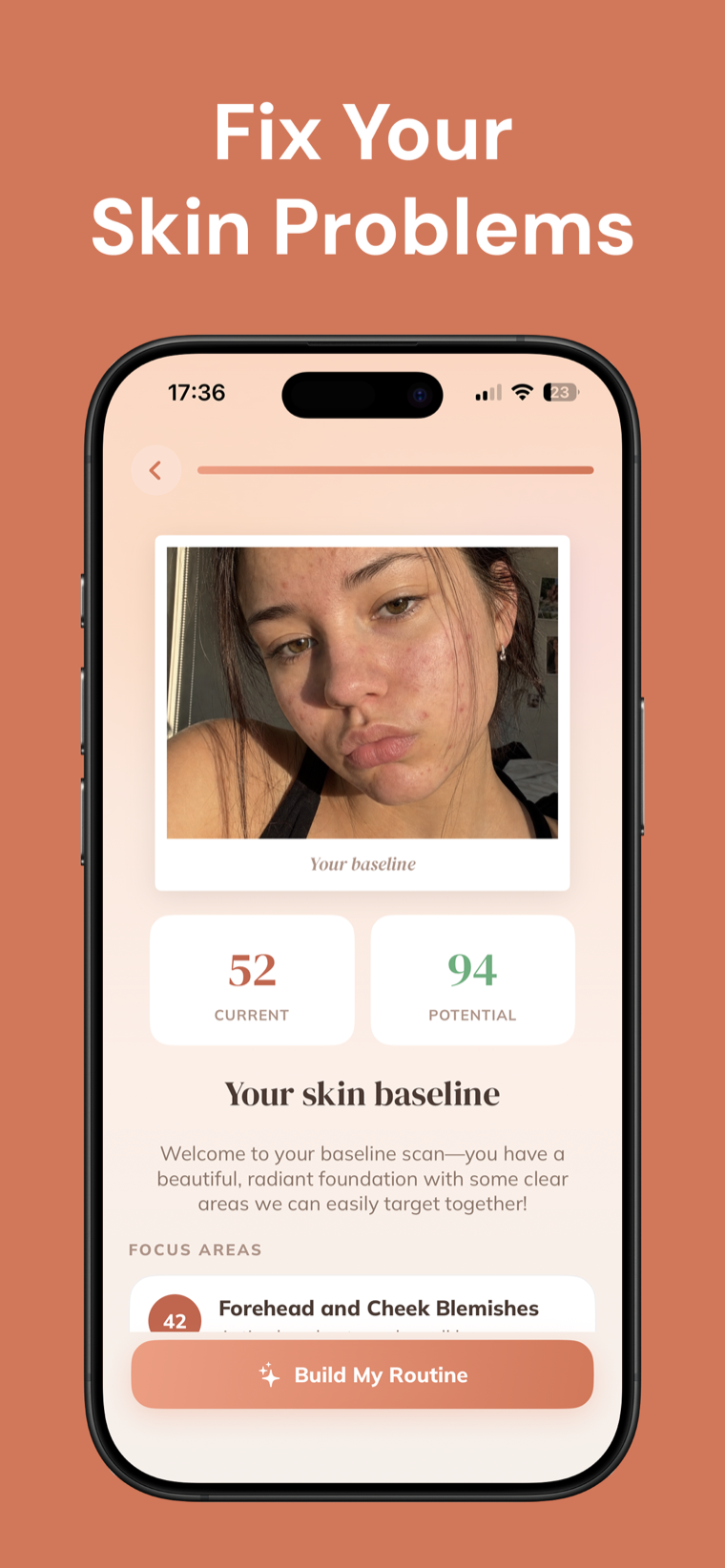 Fix your SKIN PROBLEMS — Skincare Routine showing a baseline face scan with a current and potential skin score and focus areas