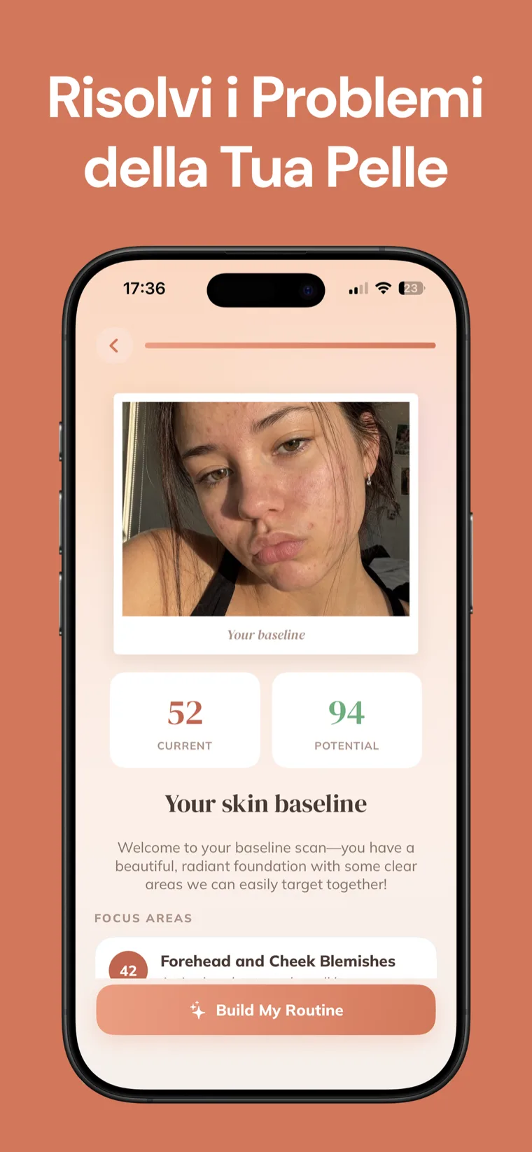Risolvi i Problemi della Tua Pelle — Skincare Routine mostra una scansione iniziale del viso con un punteggio attuale e potenziale e aree su cui concentrarsi