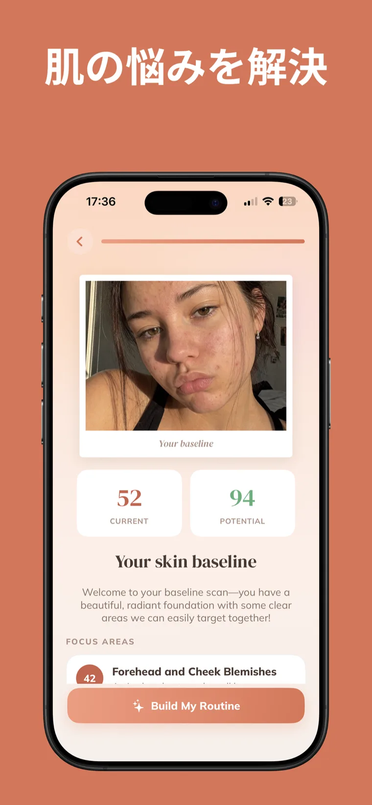 肌の悩みを解決 — スキンケア日記のベースライン顔スキャン画面。現在と潜在の肌スコア、重点項目を表示