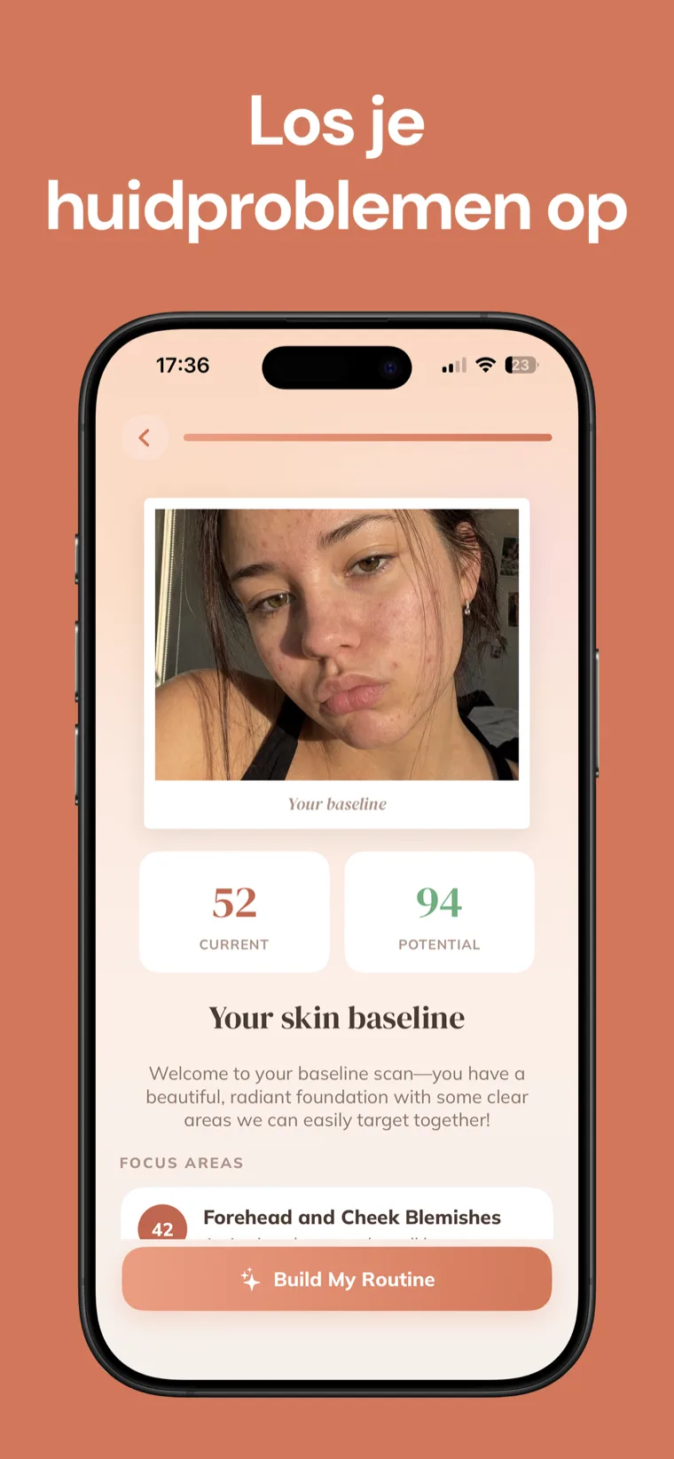 Los je huidproblemen op — Huidverzorging laat een basisscan van je gezicht zien met een huidige en potentiële huidscore en aandachtsgebieden
