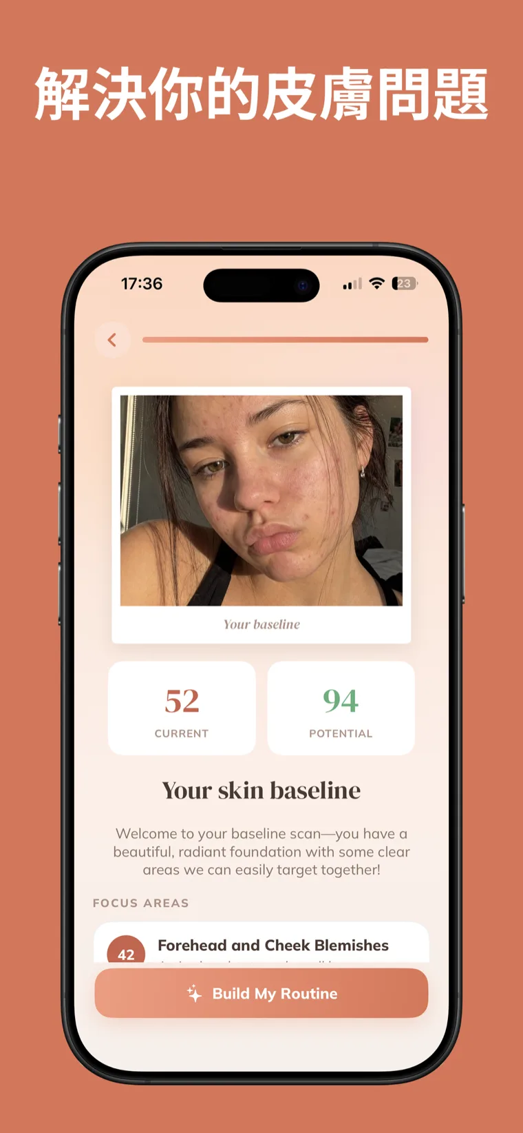 解決你的皮膚問題 — 肌膚保養 App 顯示基準臉部掃描，包含目前與潛在膚質分數及重點關注區域